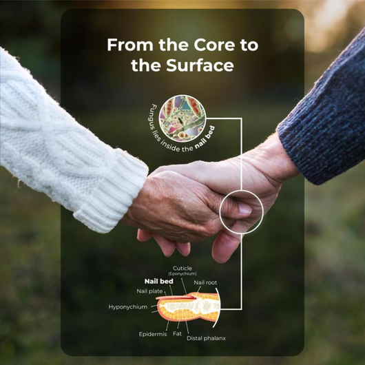 Solvex Fungus Eliminator